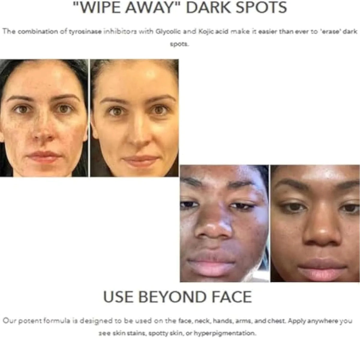 Dark Spot Repair Lotion