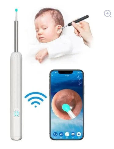 Electric Earwax Cleaning Tool | Soft-Tip Ear Care Device