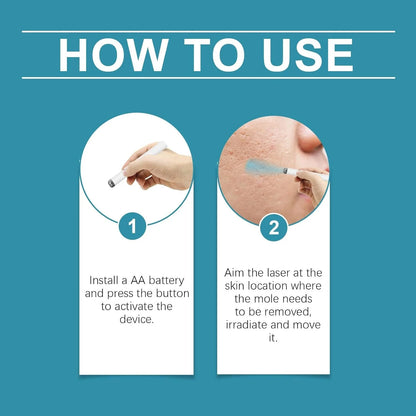 Xorita Non-Invasive Mole and Wart Removal Pen